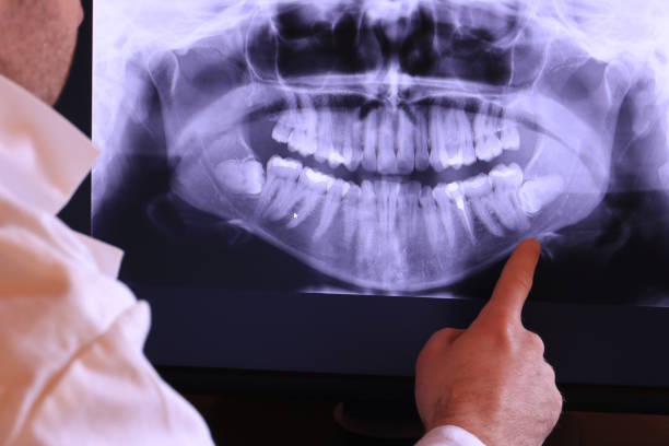 Best Emergency Broken Tooth Repair in Farmers Loop, AK